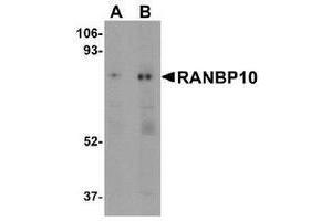 Western blot analysis of RANBP10 (arrow) in human skeletal muscle tissue lysate with RANBP10 Antibody at (A) 1 and (B) 2 μg/ml.