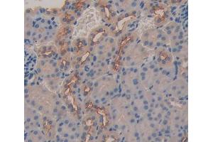 Used in DAB staining on fromalin fixed paraffin- embedded kidney tissue (ABCC6 antibody  (AA 1260-1498))