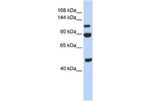 WB Suggested Anti-NARG1L Antibody Titration:  0. (NARG1L antibody  (Middle Region))