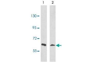 Western blot analysis of EPHA3 polyclonal antibody  in NCI-H460 (Land 1), 293 (Land 2) cell line lysates (35 ug/lane). (EPH Receptor A3 antibody  (N-Term))