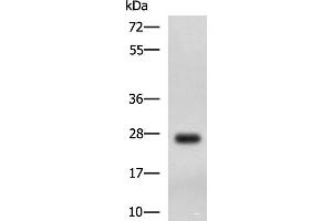 Western blot analysis of MCF7 cell lysate using DHRS2 Polyclonal Antibody at dilution of 1:750 (DHRS2 antibody)