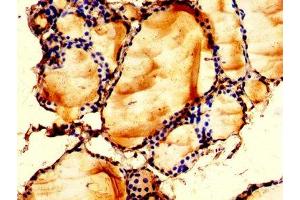IHC image of ABIN7158752 diluted at 1:200 and staining in paraffin-embedded human thyroid tissue performed on a Leica BondTM system. (LPCAT2 antibody  (AA 442-544))