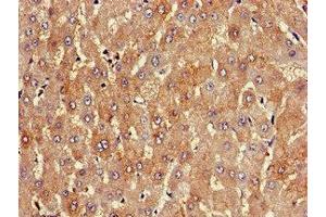 Immunohistochemistry of paraffin-embedded human liver tissue using ABIN7163820 at dilution of 1:100 (PKD1L1 antibody  (AA 921-1164))