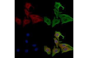 ABIN6257419 and ABIN6273804 staining Hela cells by IF/ICC.