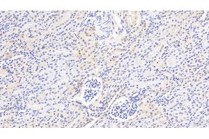 Detection of F2 in Rat Kidney Tissue using Polyclonal Antibody to Coagulation Factor II (F2) (Prothrombin antibody  (AA 201-323))