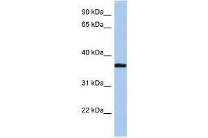 WB Suggested Anti-LDLRAP1 Antibody Titration: 0. (LDLRAP1 antibody  (N-Term))