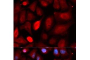 Immunofluorescence analysis of U2OS cells using PDLIM5 Polyclonal Antibody (PDLIM5 antibody)