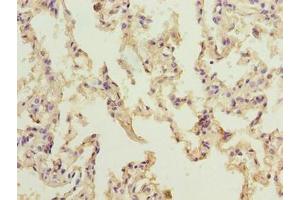 Immunohistochemistry of paraffin-embedded human lung tissue using ABIN7161614 at dilution of 1:100