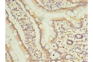 Immunohistochemistry of paraffin-embedded human small intestine tissue using ABIN7173421 at dilution of 1:100 (TRIM15 antibody  (AA 122-387))