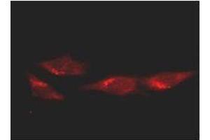 Immunofluorescence microscopy of HeLa cells using anti-p53. (p53 antibody)