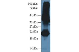 Western blot analysis of Mouse Testis lysate, using Mouse GREM1 Antibody (2 µg/ml) and HRP-conjugated Goat Anti-Rabbit antibody ( (GREM1 antibody  (AA 25-184))