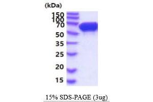 SDS-PAGE (SDS) image for Stress-Induced-phosphoprotein 1 (STIP1) (AA 1-543) protein (His tag) (ABIN5854815)