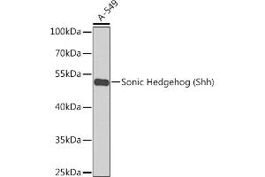 Western blot analysis of extracts of A-549 cells, using Sonic Hedgehog (Sonic Hedgehog (Shh)) antibody  at 1:1000 dilution. (Sonic Hedgehog antibody)