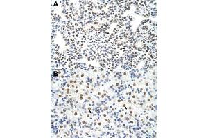 Immunohistochemical staining (Formalin-fixed paraffin-embedded sections) of human lung (A) and human liver (B) with HNRNPA3 polyclonal antibody  at 4-8 ug/mL working concentration. (HNRNPA3 antibody  (N-Term))