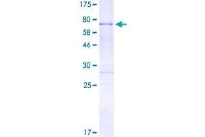 Image no. 1 for Homeobox A10 (HOXA10) (AA 1-393) protein (GST tag) (ABIN1306921) (HOXA10 Protein (AA 1-393) (GST tag))