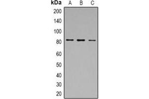 Western blot analysis of Calpain 1 expression in A549 (A), MCF7 (B), Jurkat (C) whole cell lysates. (CAPN1 antibody)
