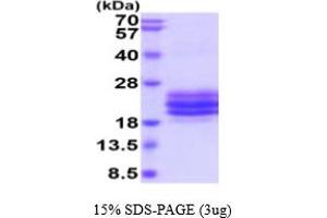 SDS-PAGE (SDS) image for CD79b Molecule, Immunoglobulin-Associated beta (CD79B) (AA 29-159) protein (His tag) (ABIN7281213) (CD79b Protein (AA 29-159) (His tag))