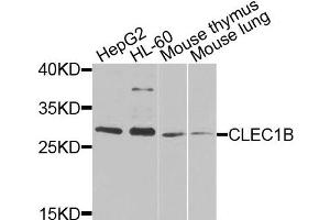 Western blot analysis of extracts of various cells, using CLEC1B antibody.