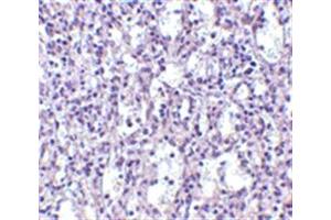 Image no. 2 for anti-TBC1 Domain Family, Member 10C (TBC1D10C) (N-Term) antibody (ABIN318913) (Carabin antibody  (N-Term))