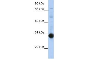 WB Suggested Anti-NR0B2 Antibody Titration:  0. (NR0B2 antibody  (Middle Region))