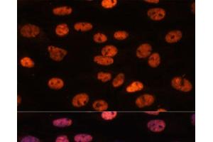 Immunofluorescence analysis of C6 cells using MYEF2 Polyclonal Antibody at dilution of 1:100. (MYEF2 antibody)