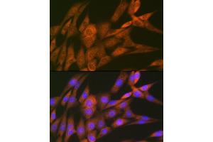 Immunofluorescence analysis of NIH-3T3 cells using 14-3-3 Theta Rabbit mAb (ABIN7265312) at dilution of 1:100 (40x lens). (14-3-3 theta antibody)