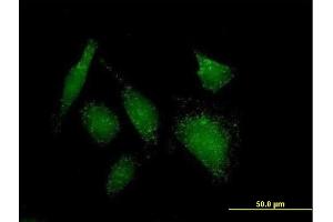 Immunofluorescence of purified MaxPab antibody to ACOT8 on HeLa cell.