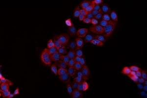IF analysis of BAG2 using anti-BAG2 antibody (ABIN3043508). (BAG2 antibody  (AA 1-211))