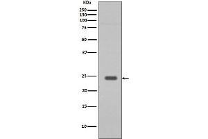 Western blot analysis of Rab9 expression in HepG2 cell lysate. (Recombinant RAB9A antibody)