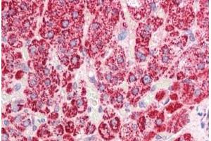 Human Adrenal: Formalin-Fixed, Paraffin-Embedded (FFPE) (SDHAF1 antibody  (C-Term))