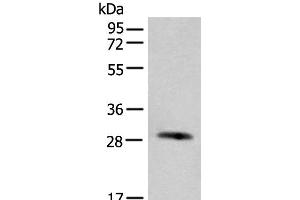 Western blot analysis of Human urinary bladder tissue lysate using CFHR2 Polyclonal Antibody at dilution of 1:550 (CFHR2 antibody)