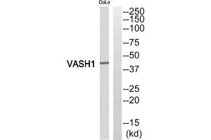 Western blot analysis of extracts from COLO205 cells, using VASH1 antibody.