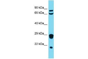 Western Blotting (WB) image for anti-Mitochondrial Ribosomal Protein L18 (MRPL18) (N-Term) antibody (ABIN2791669) (MRPL18 antibody  (N-Term))