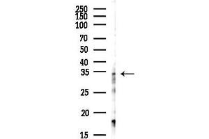 anti-Chromosome 9 Open Reading Frame 78 (C9orf98) antibody
