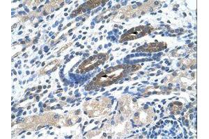 Image no. 1 for anti-BTB (POZ) Domain Containing 14A (BTBD14A) (AA 30-79) antibody (ABIN203337) (BTBD14A antibody  (AA 30-79))