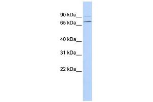YTHDF3 antibody used at 1 ug/ml to detect target protein. (YTHDF3 antibody  (N-Term))