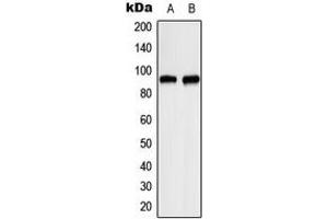 Western blot analysis of ITPKC expression in HeLa (A), RT4 (B) whole cell lysates.
