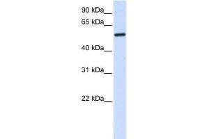 ALAS2 antibody used at 1 ug/ml to detect target protein. (ALAS2 antibody  (C-Term))