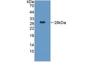 Detection of Recombinant GbL, Human using Polyclonal Antibody to G Protein Beta Subunit Like Protein (GbL) (GNB1L antibody  (AA 69-247))