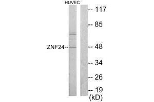 Western blot analysis of extracts from HUVEC cells, using ZNF24 antibody. (ZNF24 antibody  (N-Term))