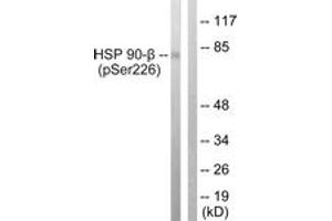 Western blot analysis of extracts from A549 cells treated with serum 20% 15', using HSP90B (Phospho-Ser226) Antibody.