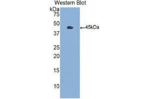 Western Blotting (WB) image for anti-Colony Stimulating Factor 2 (Granulocyte-Macrophage) (CSF2) (AA 18-144) antibody (ABIN3209613) (GM-CSF antibody  (AA 18-144))