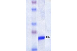 SDS-PAGE of native human 23 kDa p23 protein (ABIN1686720, ABIN1686721 and ABIN1686722). (CDK5R1 Protein)