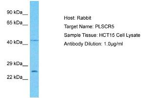 Host: Rabbit Target Name: PLSCR5 Sample Type: HCT15 Whole Cell lysates Antibody Dilution: 1. (PLSCR5 antibody  (C-Term))