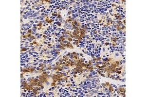 Immunohistochemistry of paraffin embedded mouse Immune spleen using CXCR1 (ABIN7073465) at dilution of 1: 2000 (400x lens) (CXCR1 antibody)