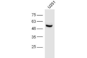 U251 lysates probed with IRF3 (Ser396) Polyclonal Antibody, unconjugated  at 1:300 overnight at 4°C followed by a conjugated secondary antibody at 1:10000 for 60 minutes at 37°C. (IRF3 antibody  (pSer396))
