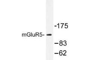 Image no. 1 for anti-Glutamate Receptor, Metabotropic 5 (GRM5) antibody (ABIN317705) (Metabotropic Glutamate Receptor 5 antibody)