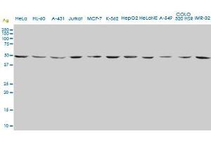 ENO2 monoclonal antibody (M01), clone 1A3. (ENO2/NSE antibody  (AA 325-434))