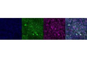 Immunohistochemistry (IHC) image for anti-Tryptophan Hydroxylase 2 (TPH2) antibody (ABIN7456102) (Tryptophan Hydroxylase 2 antibody)