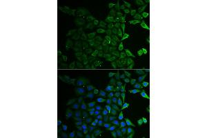 Immunofluorescence analysis of HeLa cells using C21orf33 antibody.